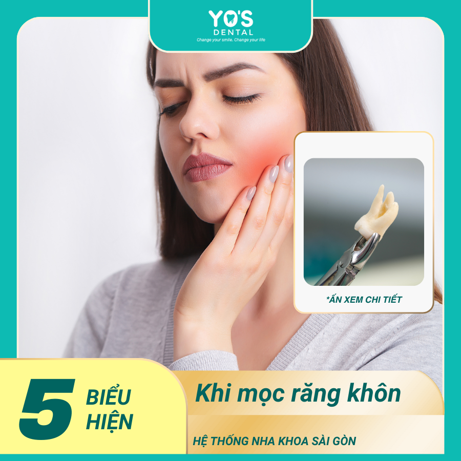 Các Biểu Hiện Khi Mọc Răng Khôn