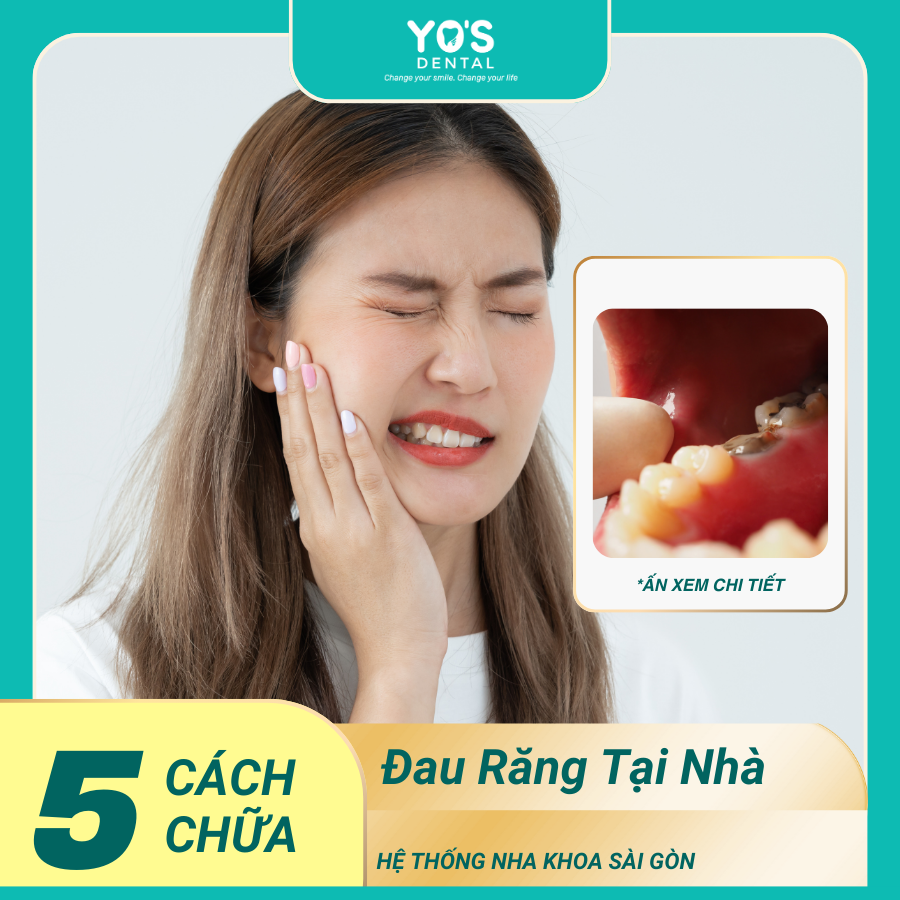 5 cách chữa đau răng tại nha