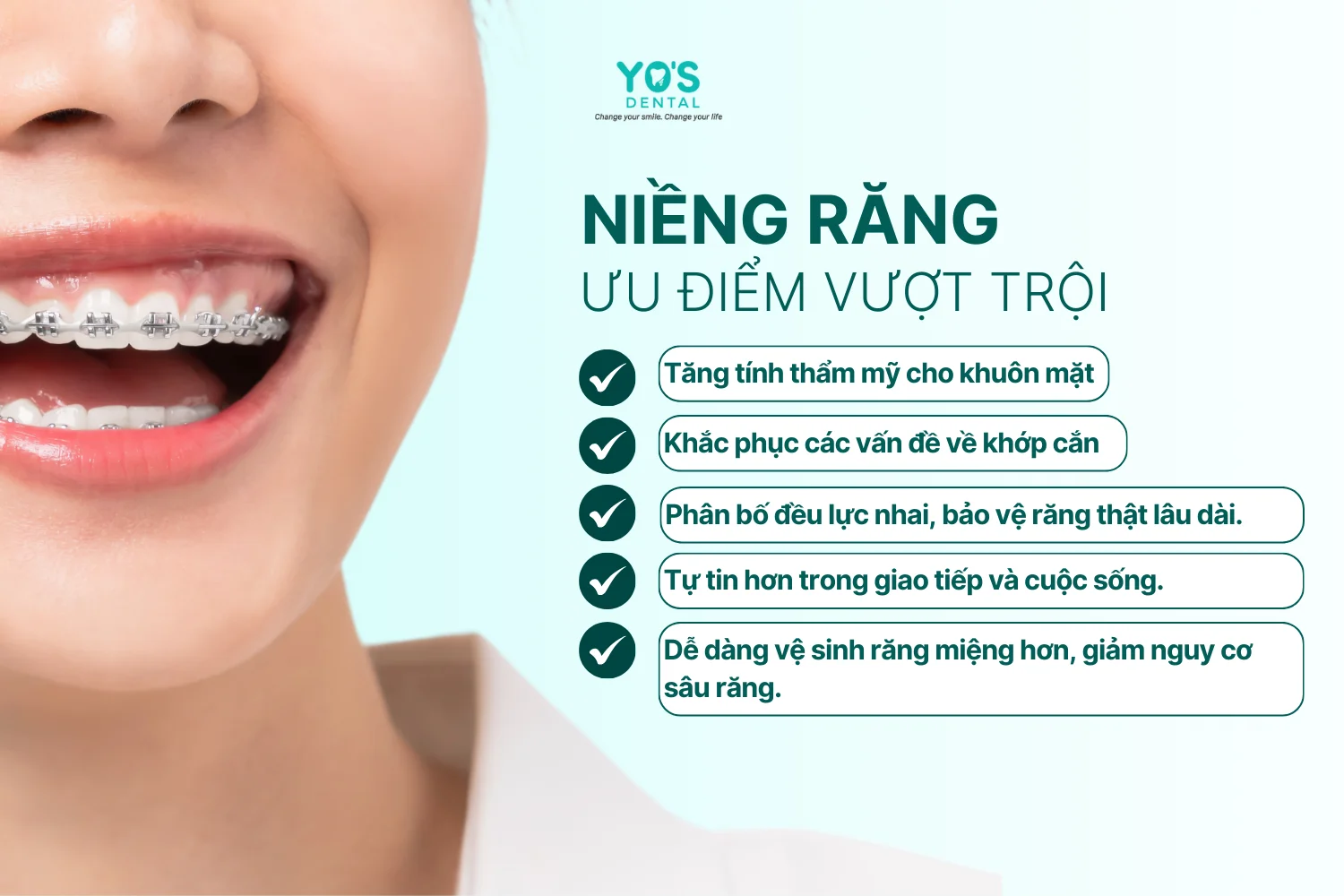 Niềng răng - Thông tin dịch vụ chung1