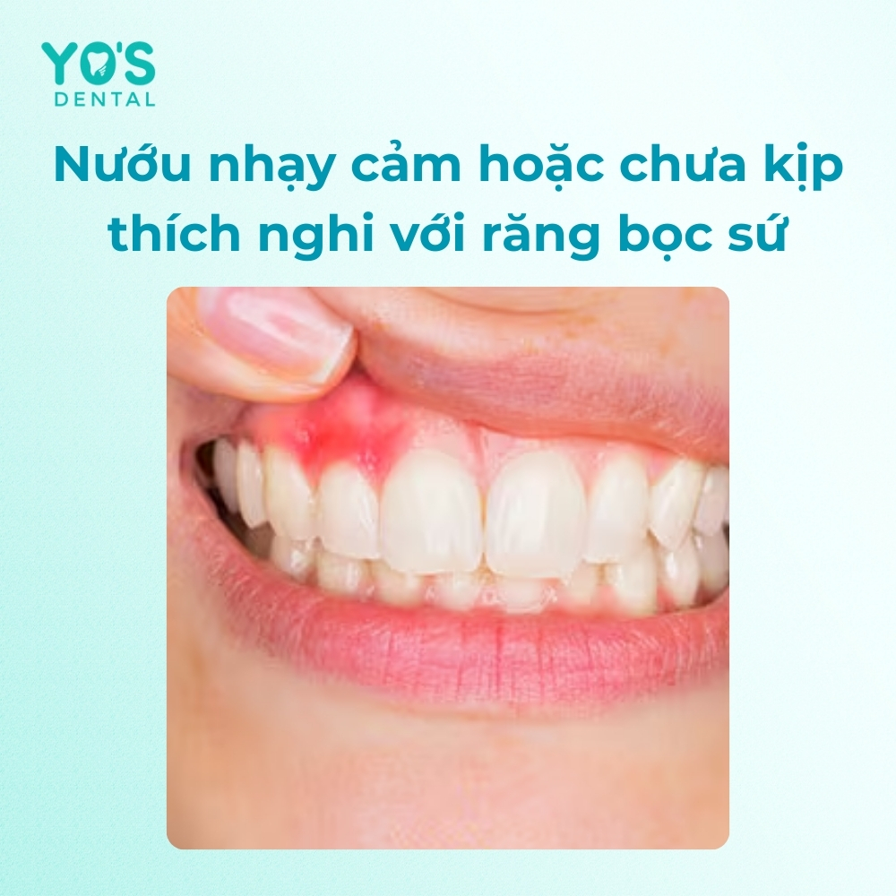 Nướu nhạy cảm dễ bị đau khi nhai
