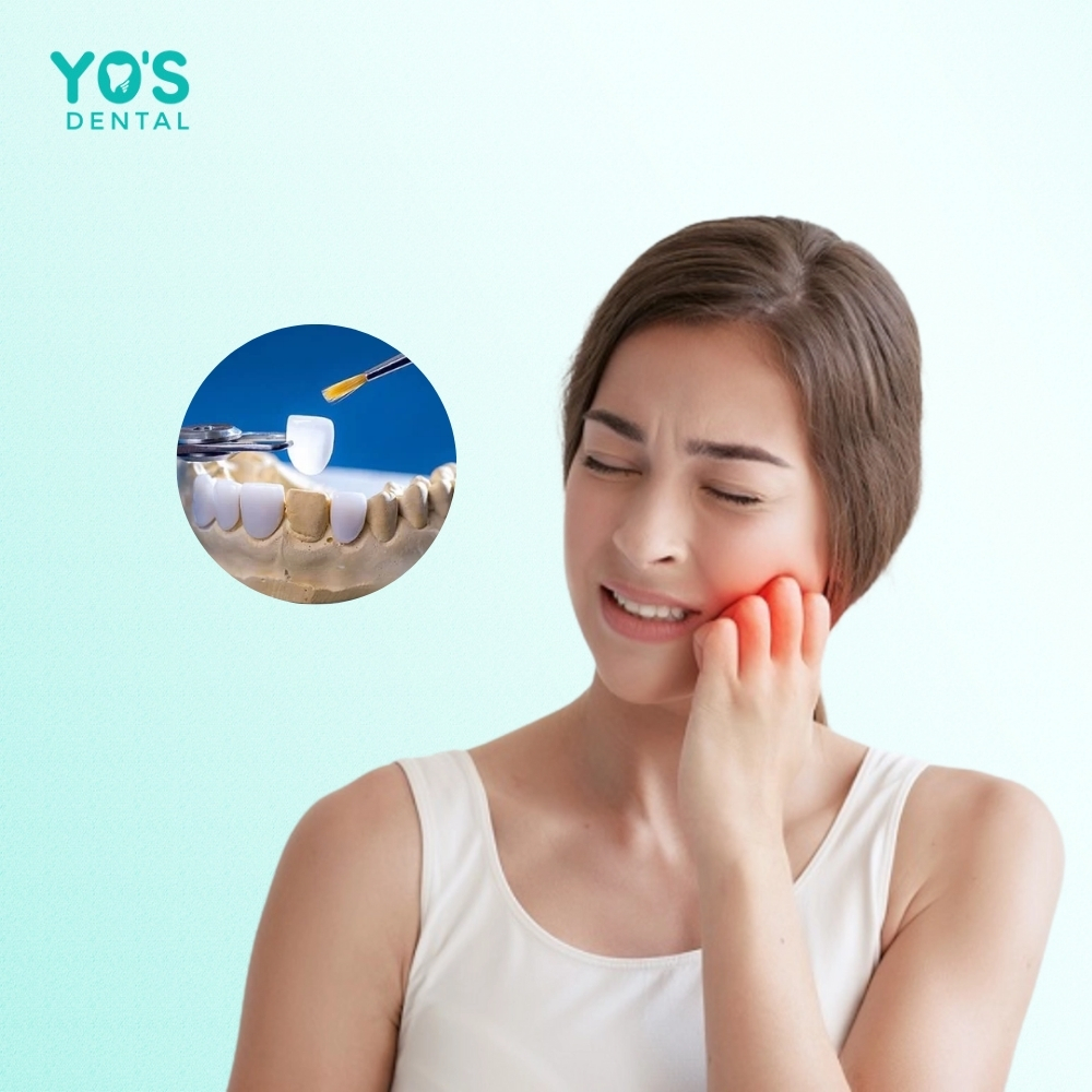 Rò rỉ keo nha khoa cũng là nguyên nhân răng bị đau khi nhai