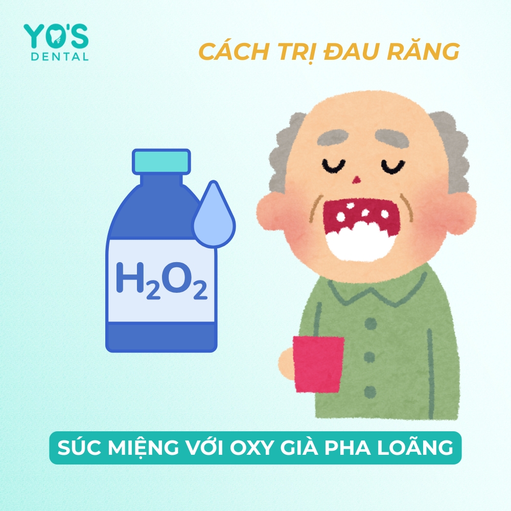 Súc miệng với oxy già pha loãng là mẹo trị đau răng hữu ích