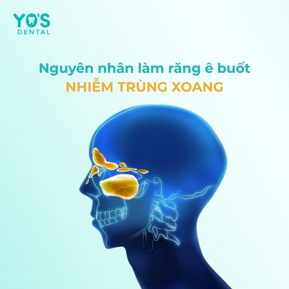 Nhiễm trùng xoang