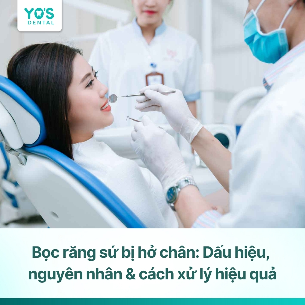 Bọc răng sứ bị hở chân: Dấu hiệu, nguyên nhân & cách xử lý hiệu quả