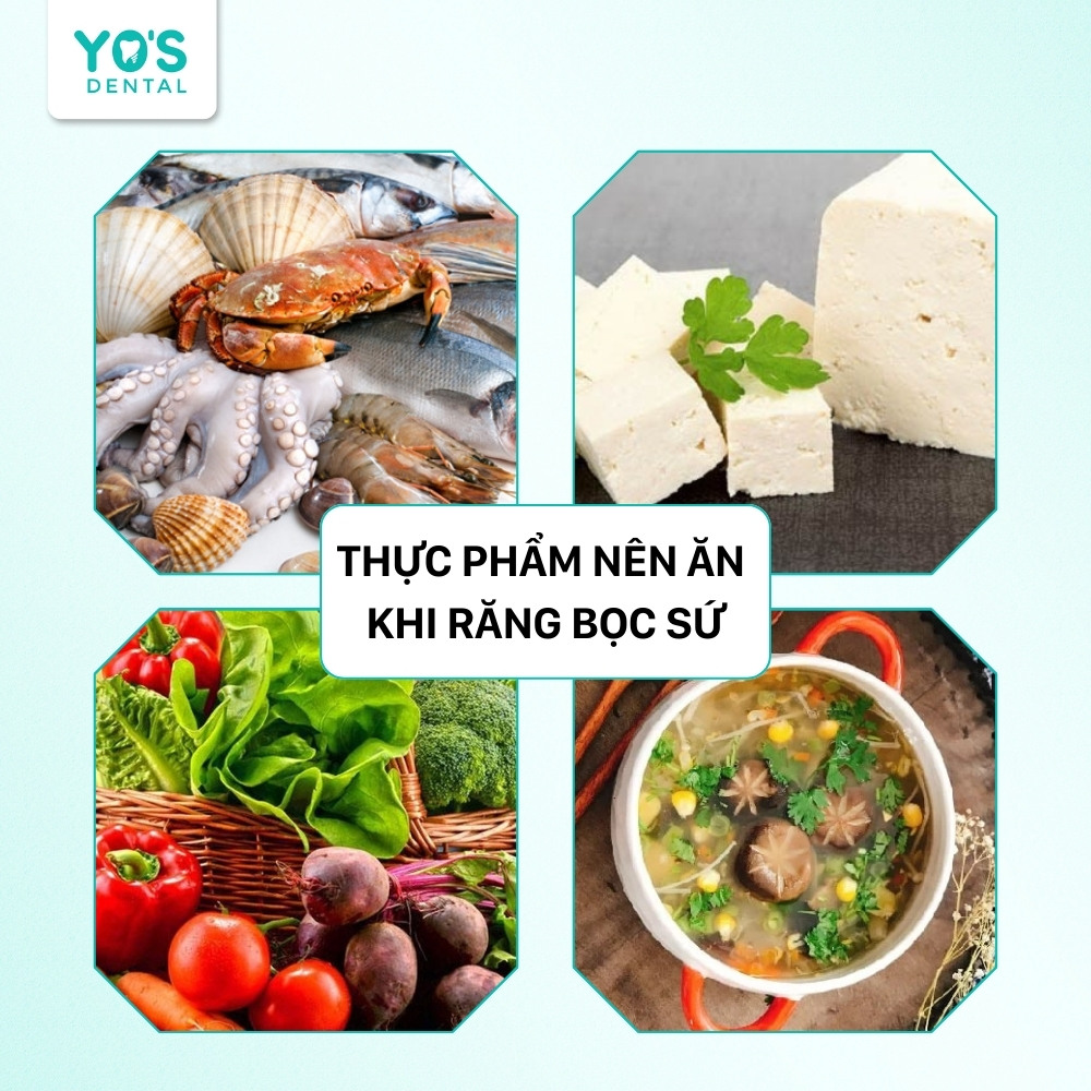 Các loại thực phẩm nên ăn sau khi bọc răng sứ để răng không bị nhức