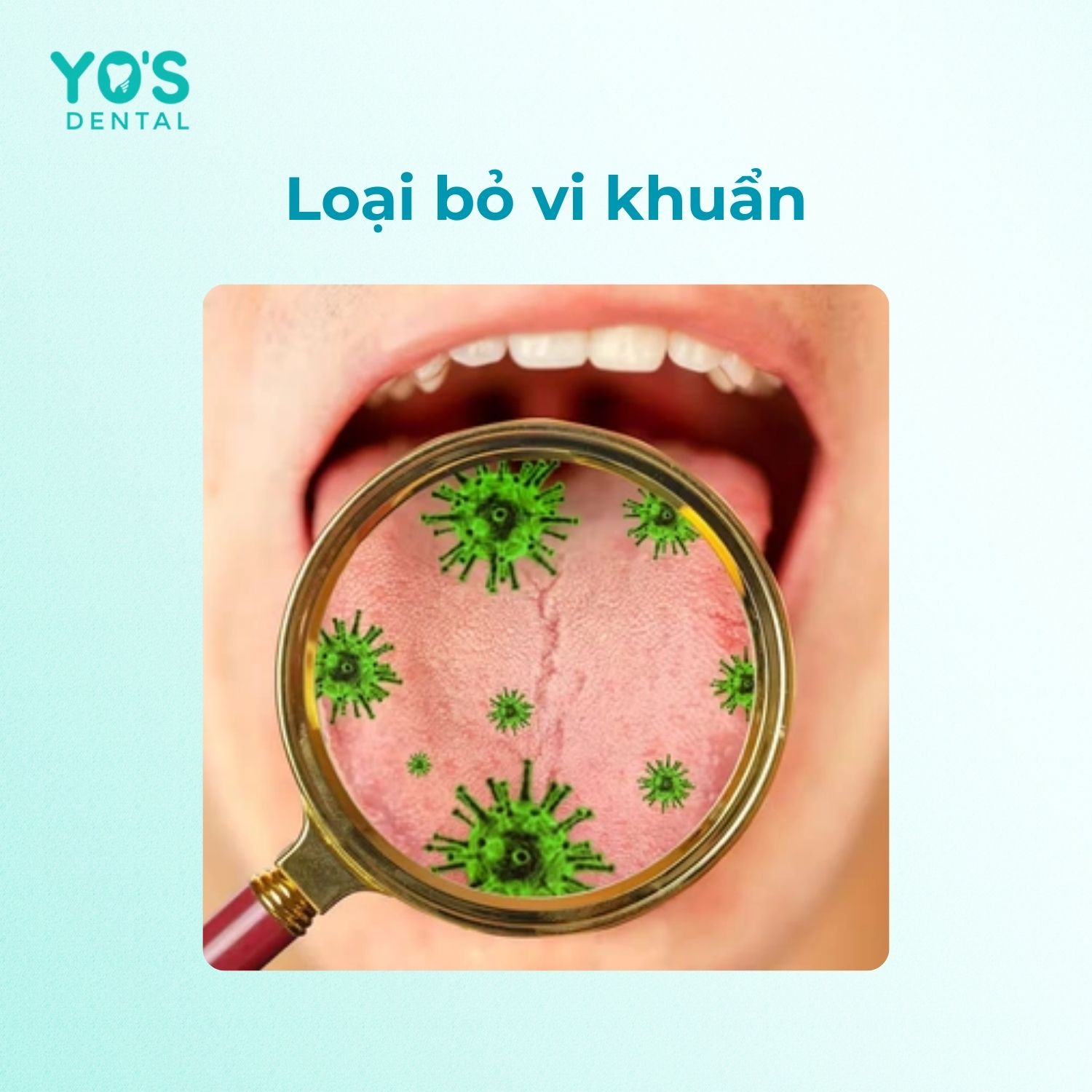 Vệ sinh lưỡi đúng cách sẽ loại bỏ đáng kể vi khuẩn Vệ sinh lưỡi đúng cách sẽ loại bỏ đáng kể vi khuẩn