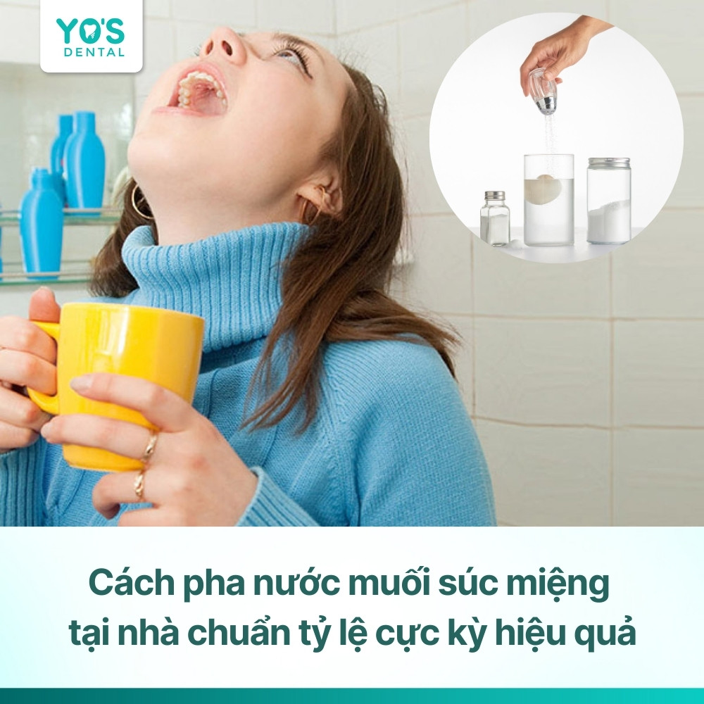Cách pha nước muối súc miệng tại nhà chuẩn tỷ lệ cực kỳ hiệu quả