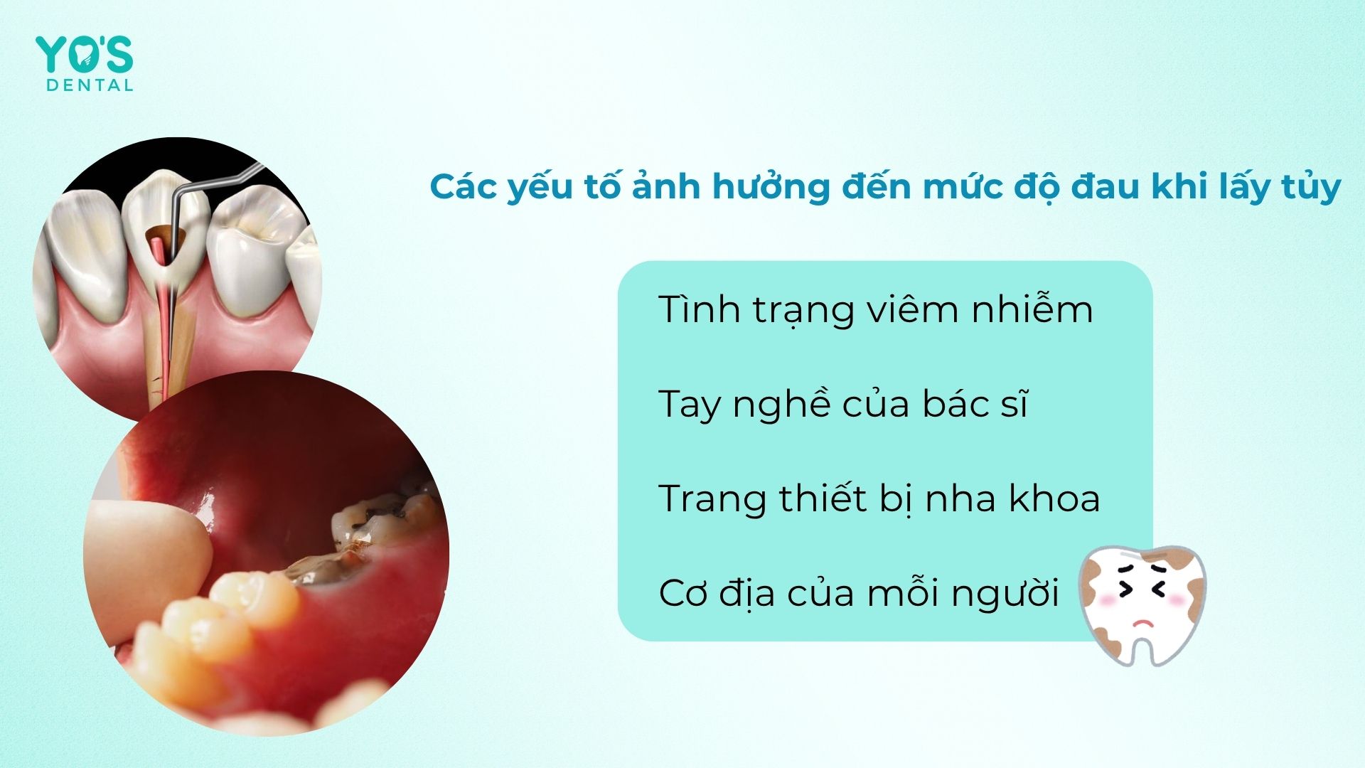 Mức độ đau khi lấy tủy còn tùy thuộc vào nhiều yếu tố khác nhau