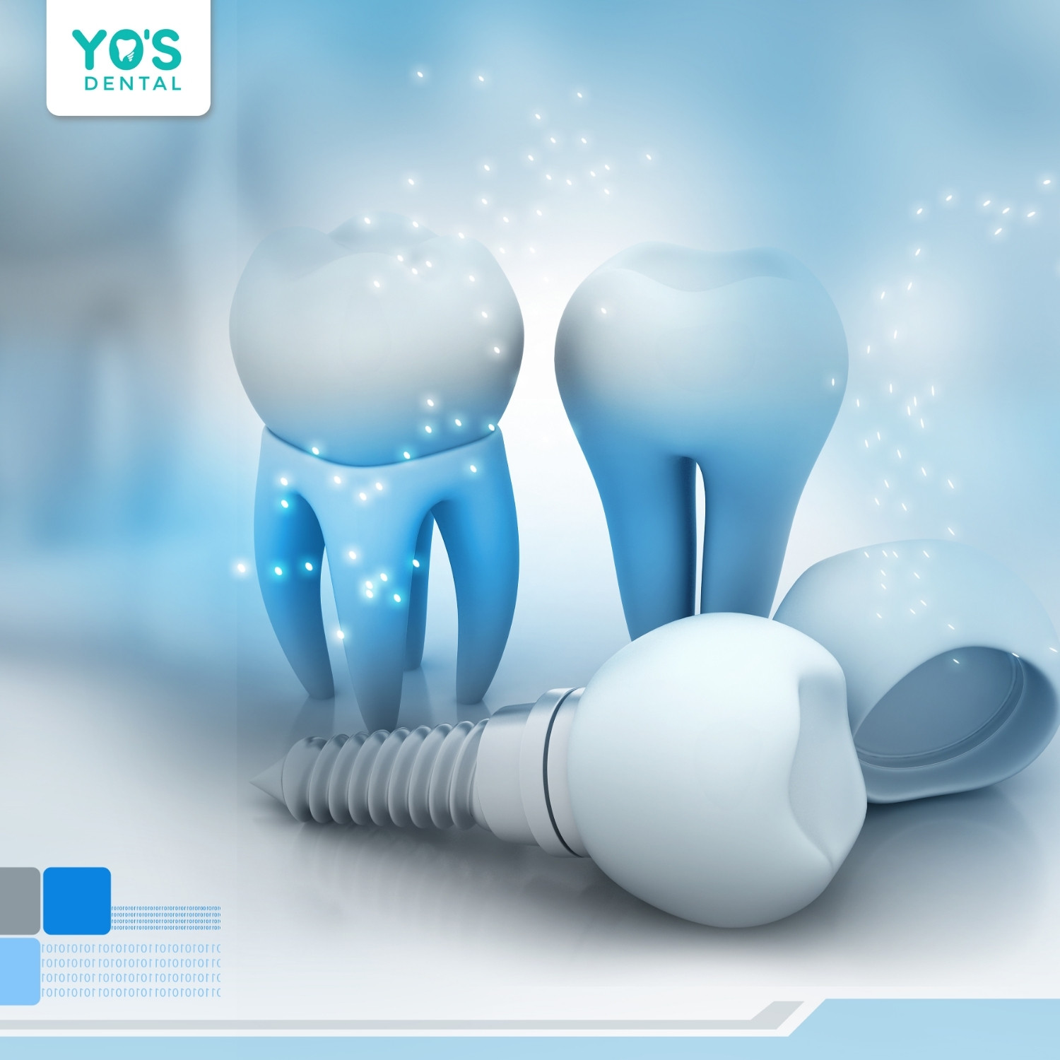 Chi phí trồng răng Implant cao gấp 2 - 3 lần làm răng sứ