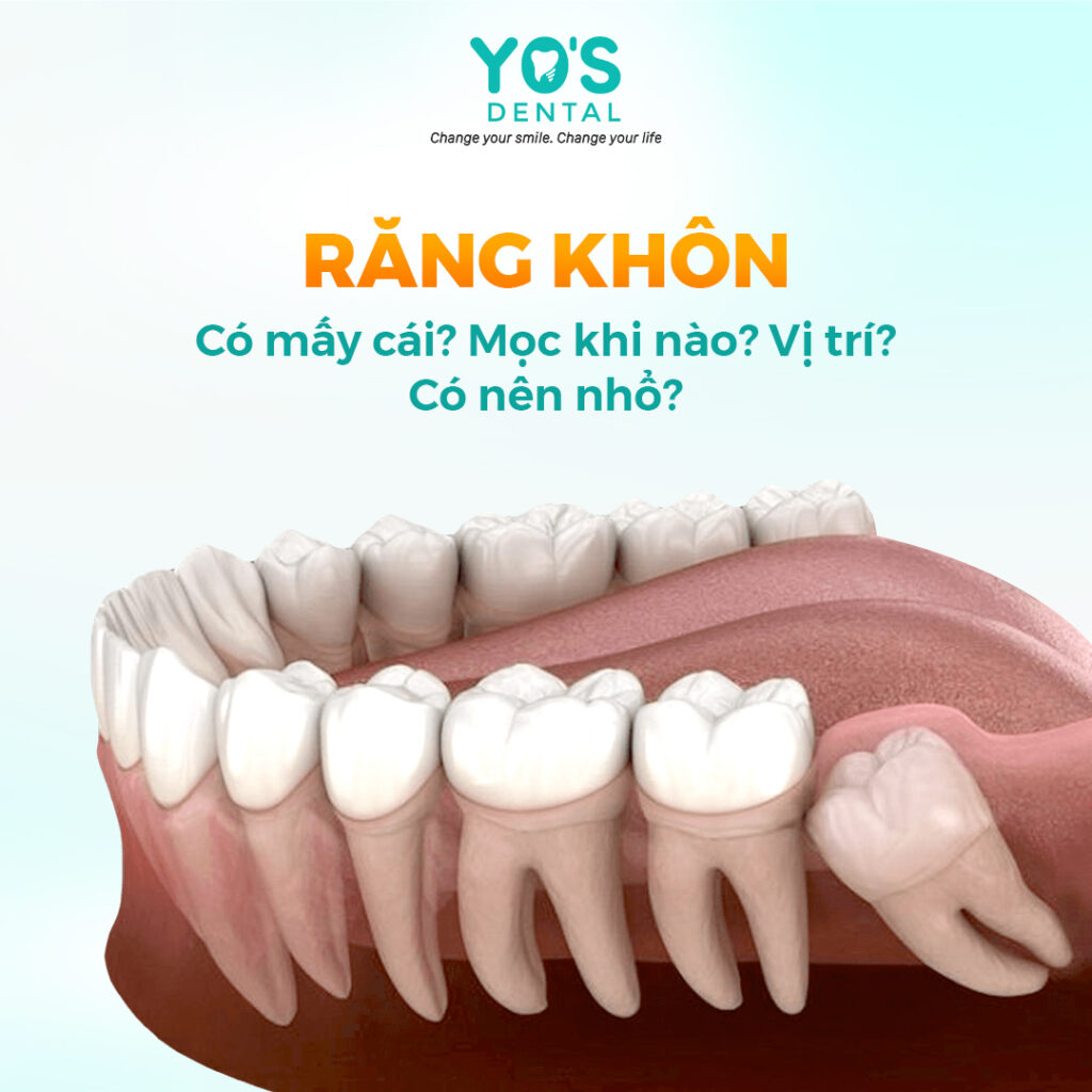 Tìm hiểu về răng khôn chi tiết