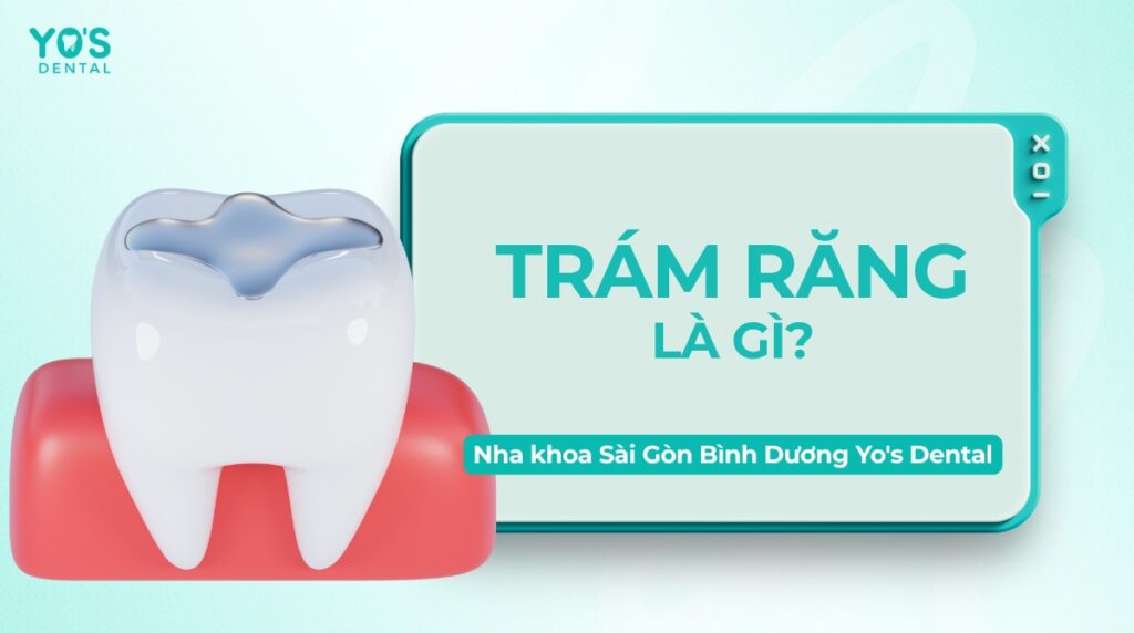 Trám răng là gì