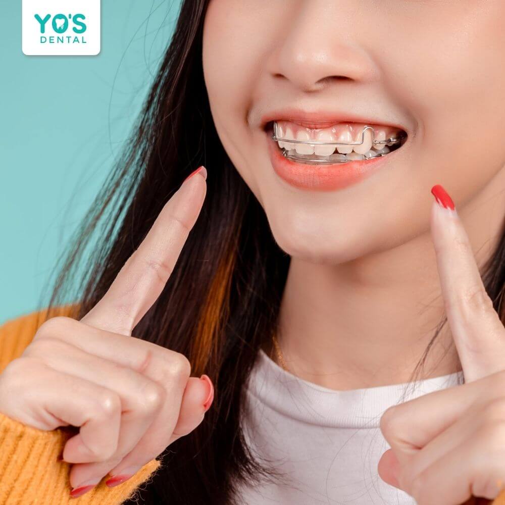 Niềng răng ở tuổi 40 vẫn mang lại hiệu quả nếu đảm bảo các điều kiện cần thiết