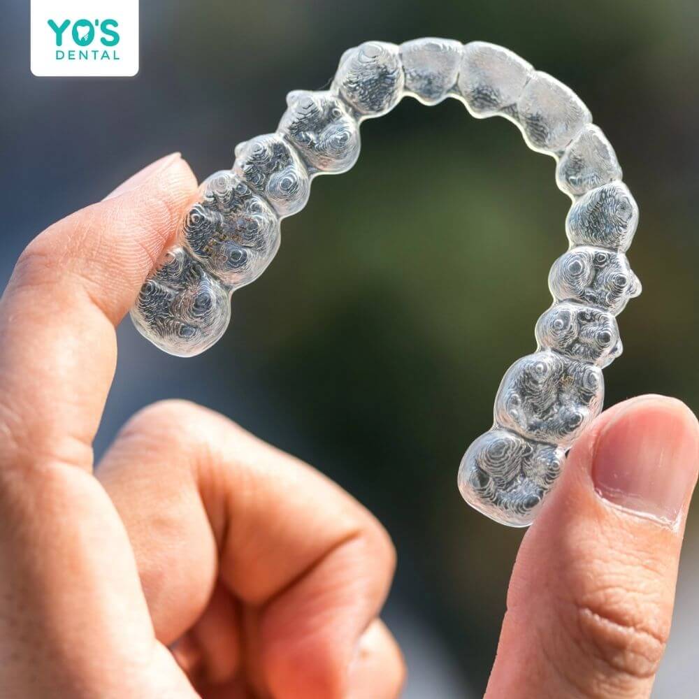 Niềng răng Invisalign phù hợp với người có thu nhập cao và hiệu quả nhất với trường hợp răng lệch lạc mức độ nhẹ đến trung bình