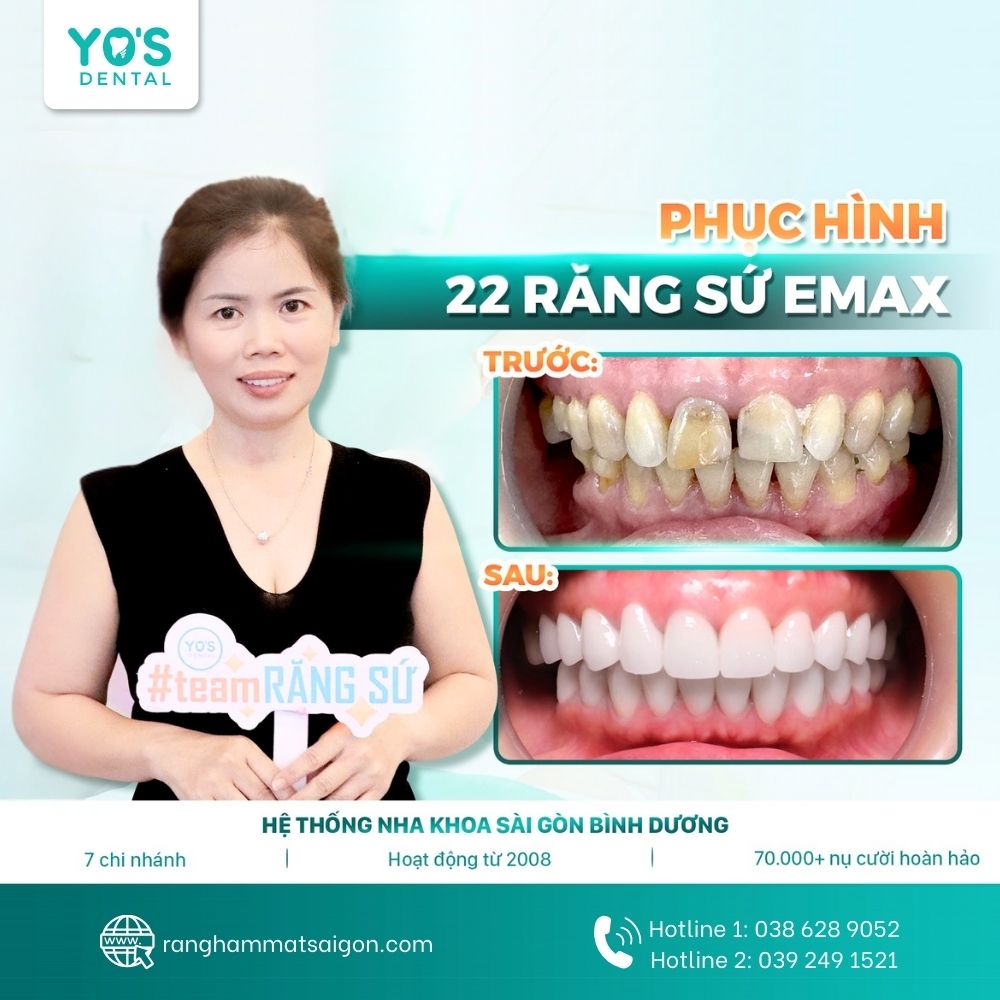 Trải nghiệm dịch vụ nha khoa uy tín để nụ cười khỏe đẹp và bền vững