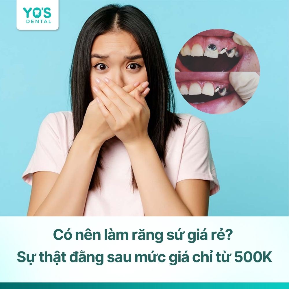 Có nên làm răng sứ giá rẻ? Sự thật đằng sau mức giá chỉ từ 500K