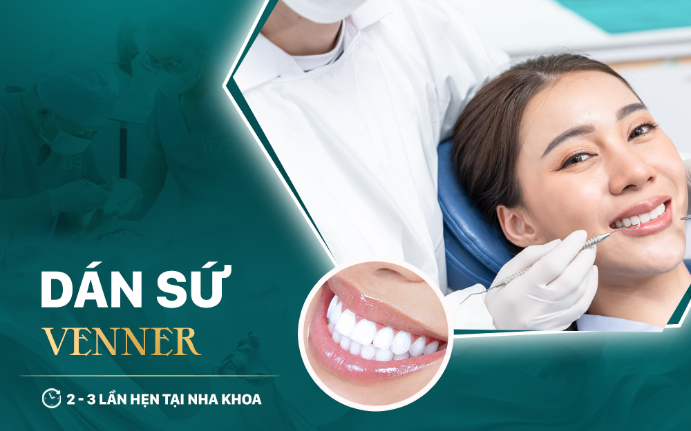 Dán sứ Veneer tại Yo’s Dental nhanh chóng, chỉ với 2 - 3 lần hẹn tại nha khoa
