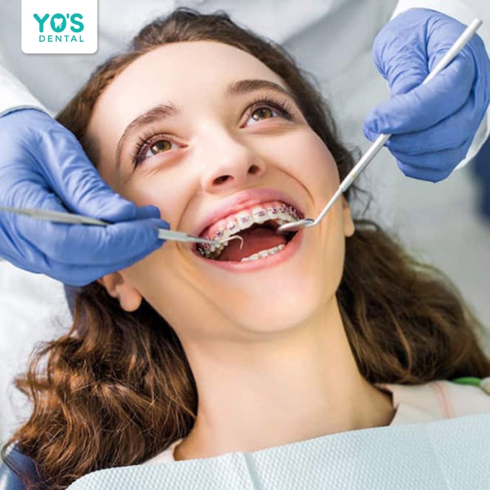 Bác sĩ chỉnh nha thiếu kinh nghiệm, kỹ thuật không chuẩn xác