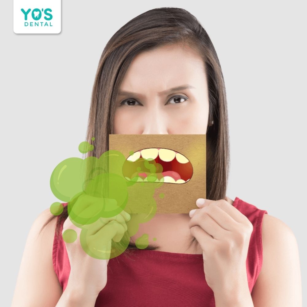 Hôi miệng sau làm răng sứ là dấu hiệu sai sót hoặc chăm sóc sai