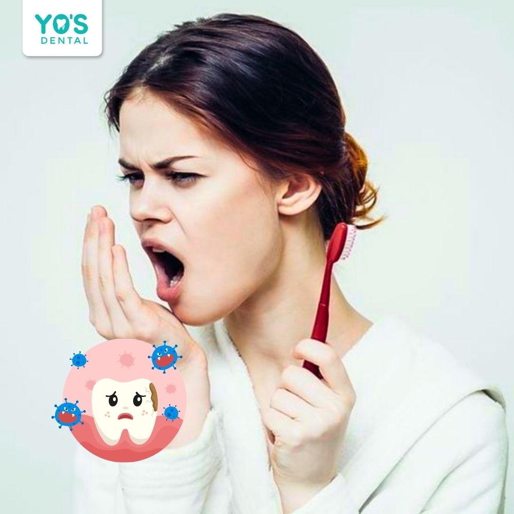 Vệ sinh răng miệng kém là một trong những lý do gây hôi miệng