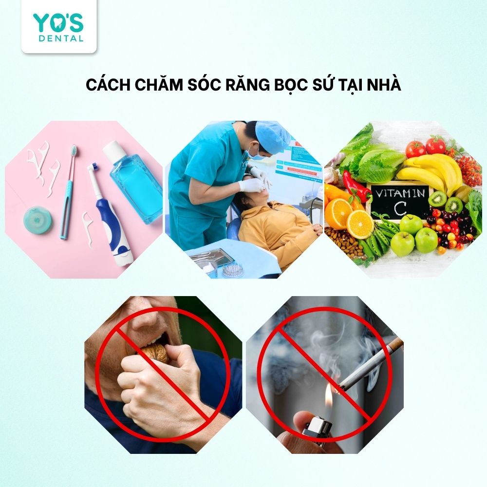 Hướng dẫn cách chăm sóc răng bọc sứ tại nhà hiệu quả
