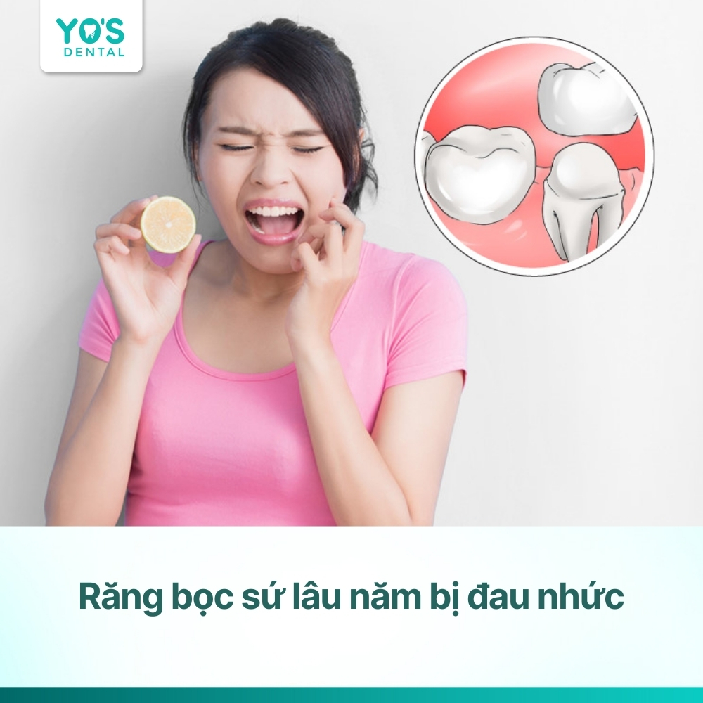 Răng bọc sứ lâu năm bị đau nhức: Nguyên nhân và cách xử lý
