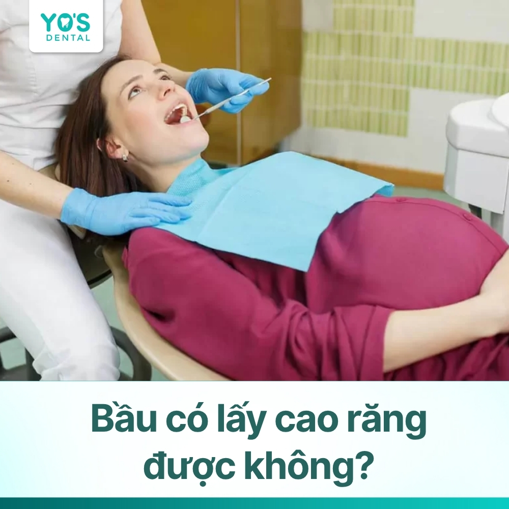 Bầu có lấy cao răng được không? Thời điểm nào an toàn nhất?