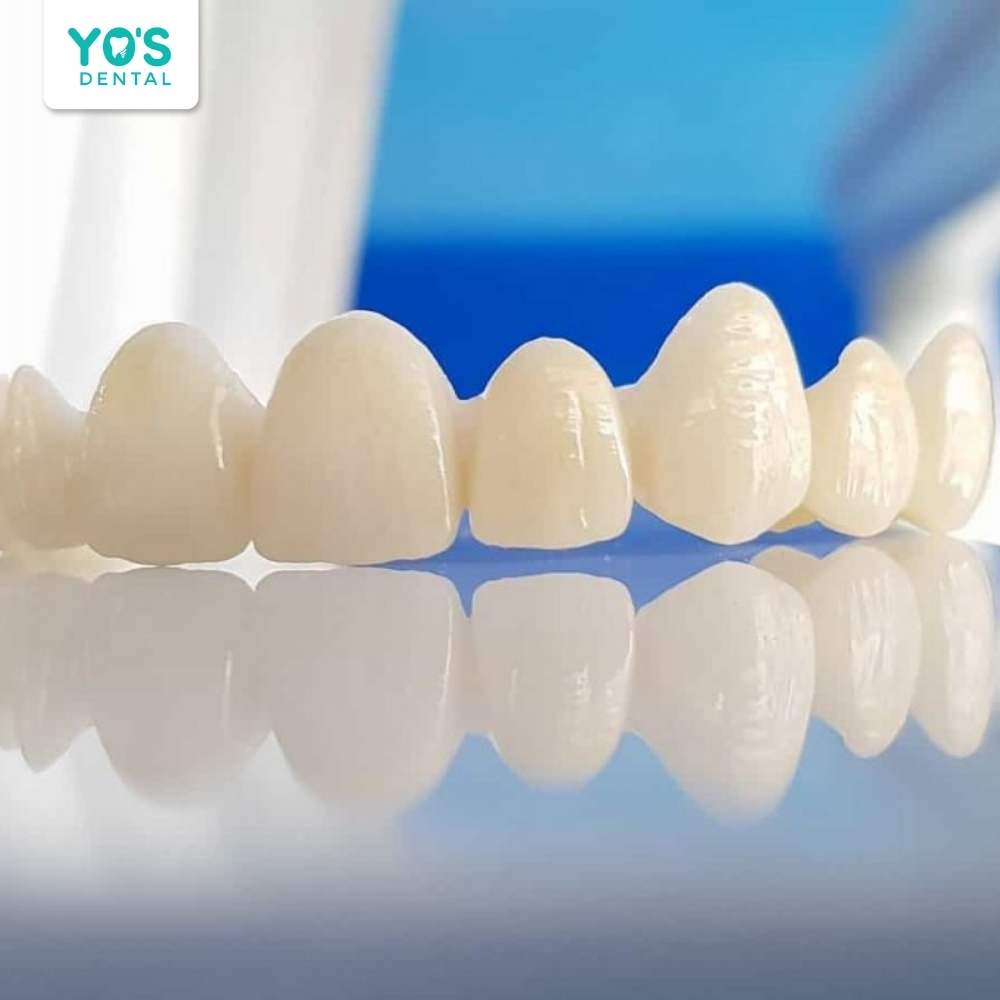 HT Smile được sản xuất với công nghệ sứ nguyên khối