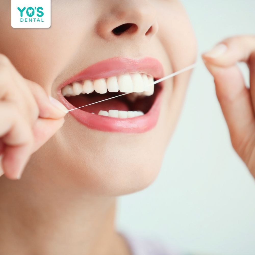Hướng dẫn cách chăm sóc răng sứ hạn chế đen nướu