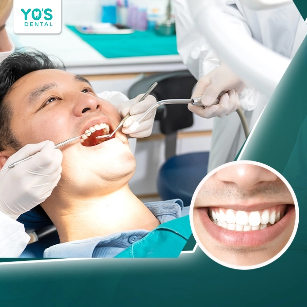 Đội ngũ bác sĩ tại Yo’s Dental sẽ tư vấn 1:1 cho từng ca để bạn yên tâm điều trị