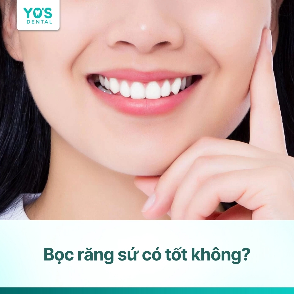 Bọc răng sứ có tốt không? Ưu và nhược điểm của bọc răng sứ