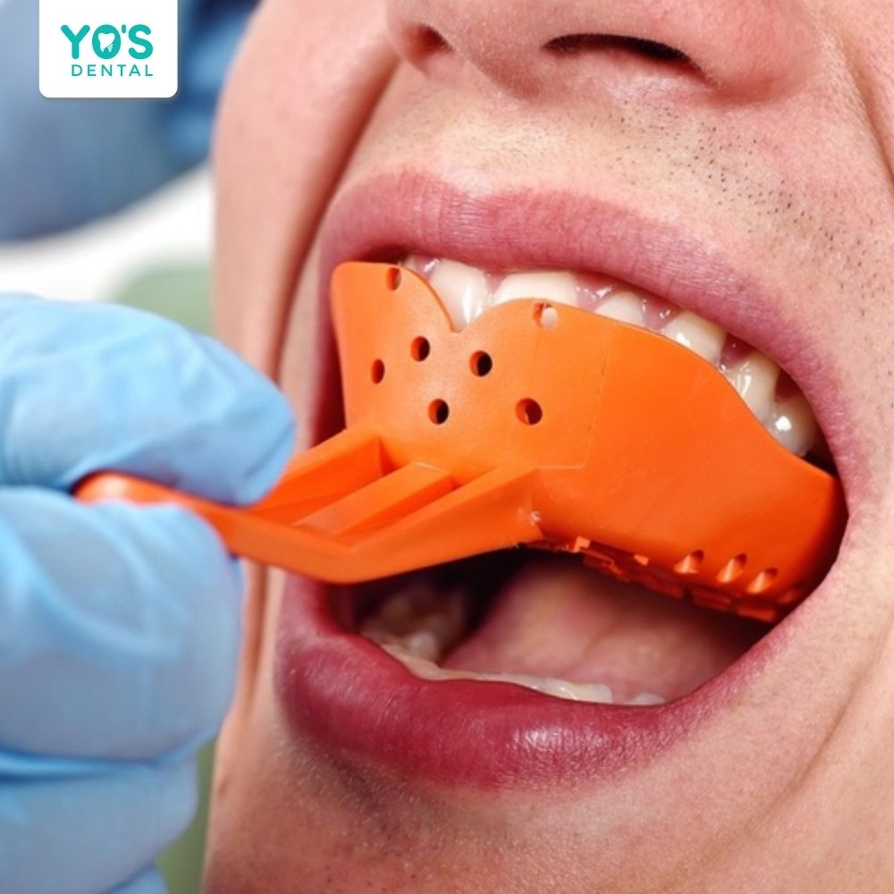 Nha sĩ cần thăm khám kỹ lưỡng để tư vấn cho bạn phương pháp trồng răng tối ưu nhất