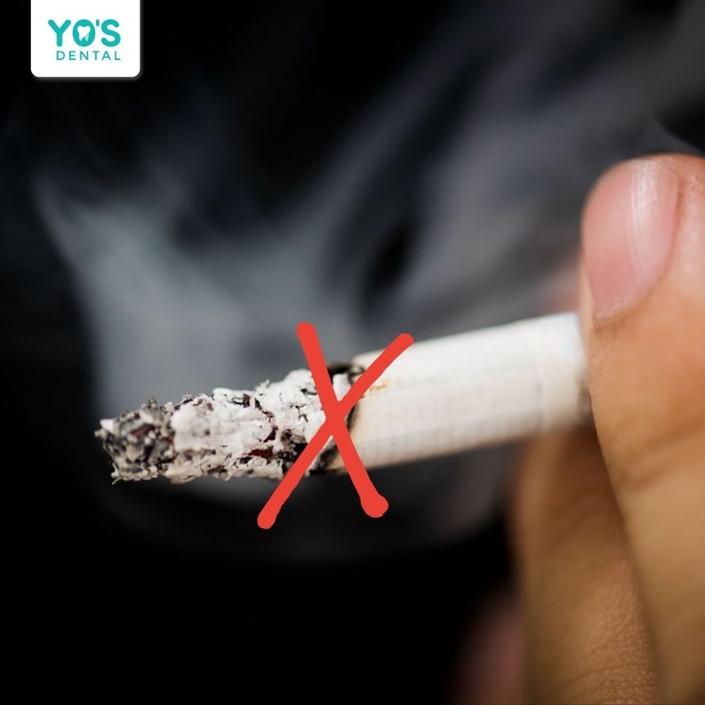 Tuyệt đối không hút thuốc ngay sau khi vừa nhổ răng!
