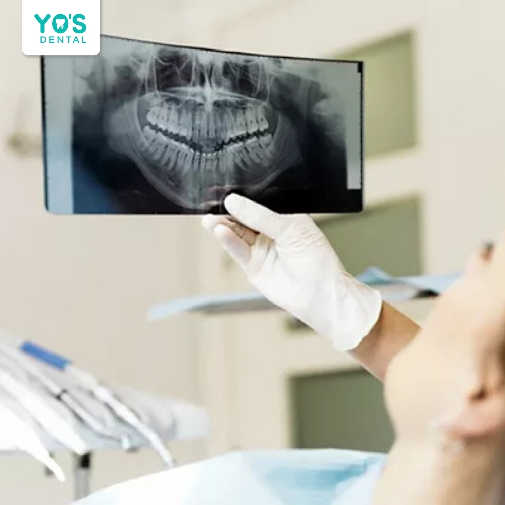 Máy X-quang nha khoa hiện đại sử dụng liều tia cực thấp không ảnh hưởng đến sữa mẹ