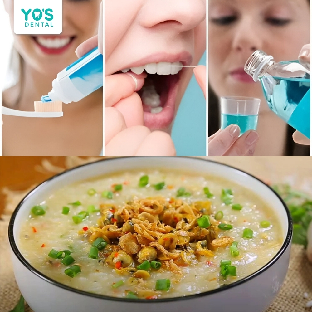 Vệ sinh răng nướu đúng cách và ưu tiên những thức ăn mềm như cháo, súp dinh dưỡng.