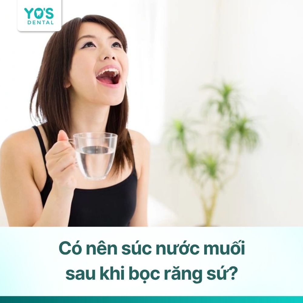 Có nên súc nước muối sau khi bọc răng sứ? Hướng dẫn thời điểm phù hợp