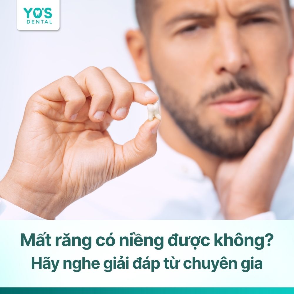 Mất răng có niềng được không? Giải pháp tại Nha khoa Yo’s Dental