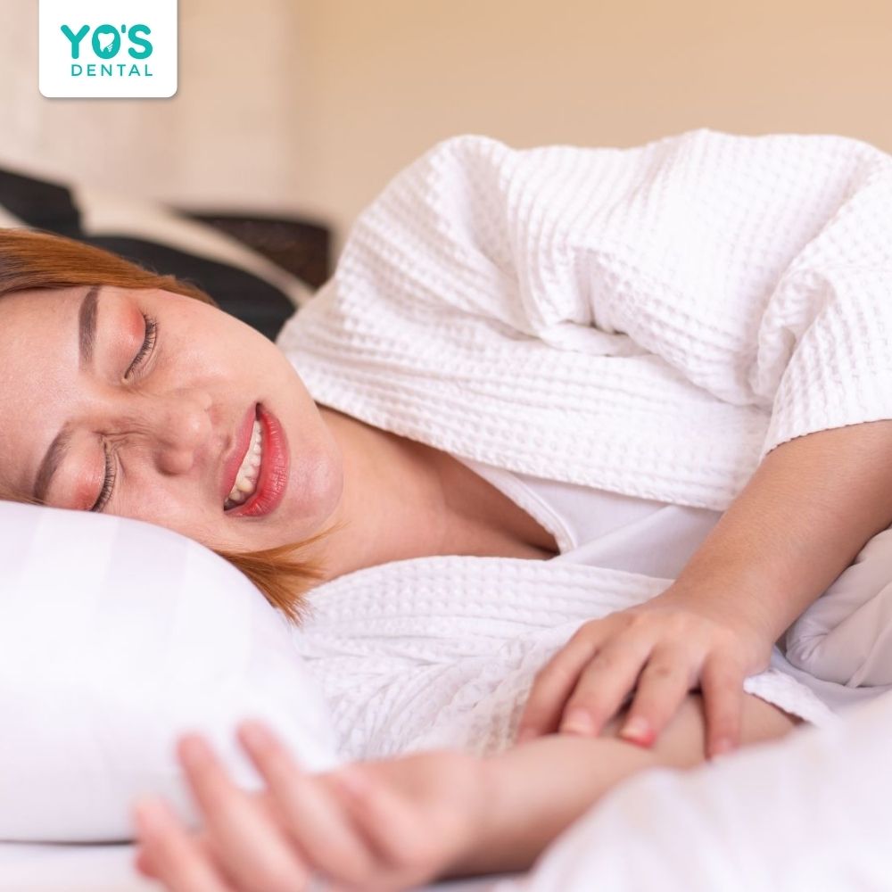 Thói quen nghiến răng khi ngủ có thể làm hỏng mặt dán sứ