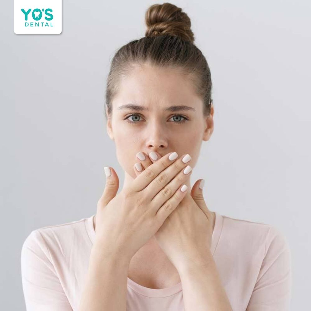 Kẽ hở tạo điều kiện cho vi khuẩn tích tụ gây hôi miệng