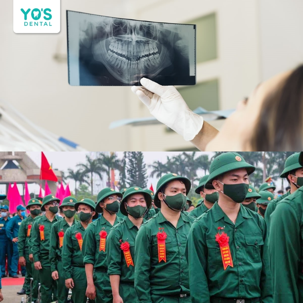 Việc niềng răng gần tuổi nhập ngũ có thể gây ra nhiều bất tiện