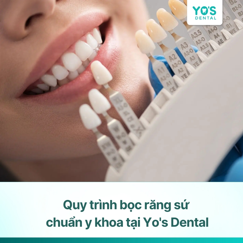 Quy trình bọc răng sứ chuẩn y khoa tại Yo's Dental