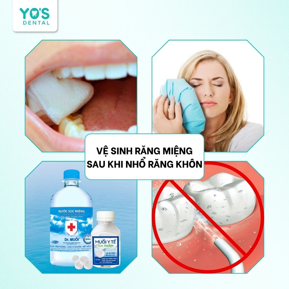 Cách vệ sinh răng miệng dành cho người vừa nhổ răng khôn