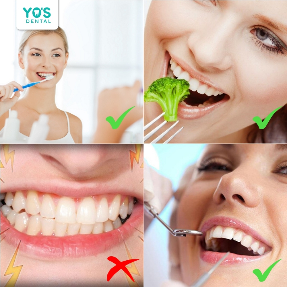 Chăm sóc đúng cách giúp duy trì độ bền và vẻ đẹp của răng sứ