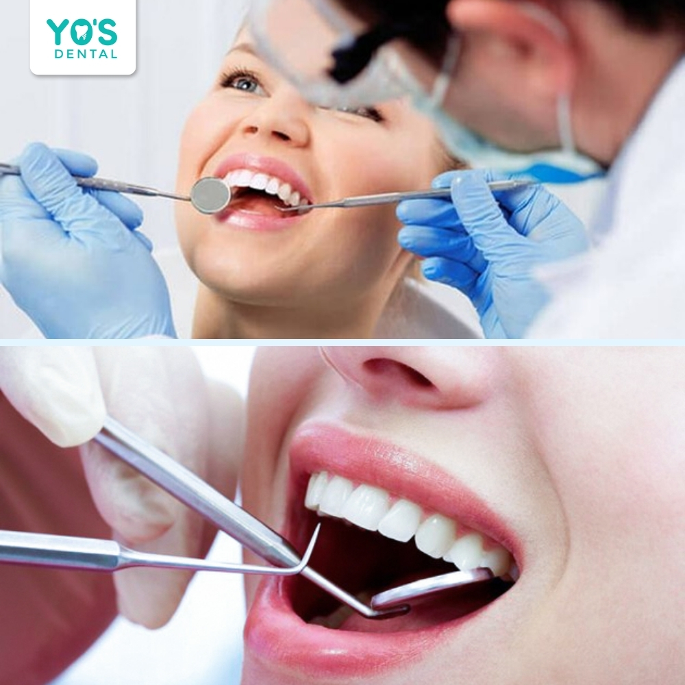Tuân thủ hướng dẫn của bác sĩ để đảm bảo độ bền của răng sứ.