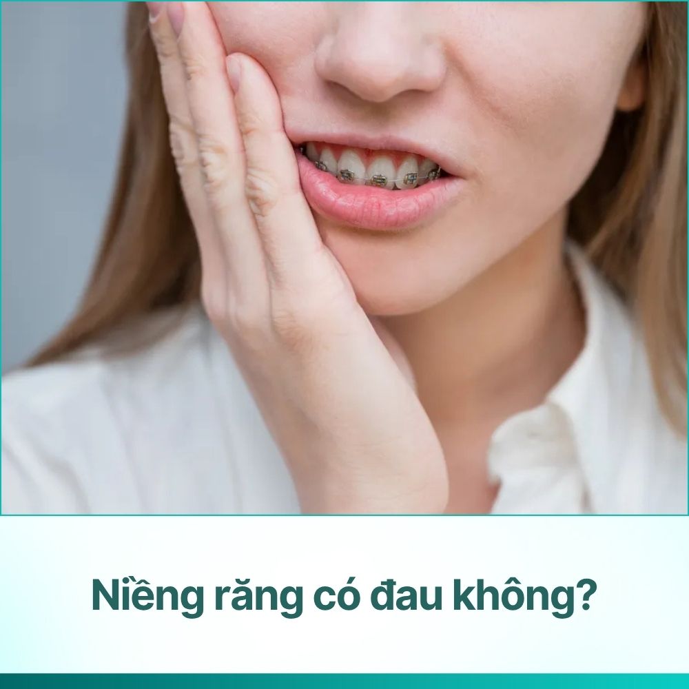 Niềng răng có đau không? Thời gian phục hồi và biện pháp giảm đau