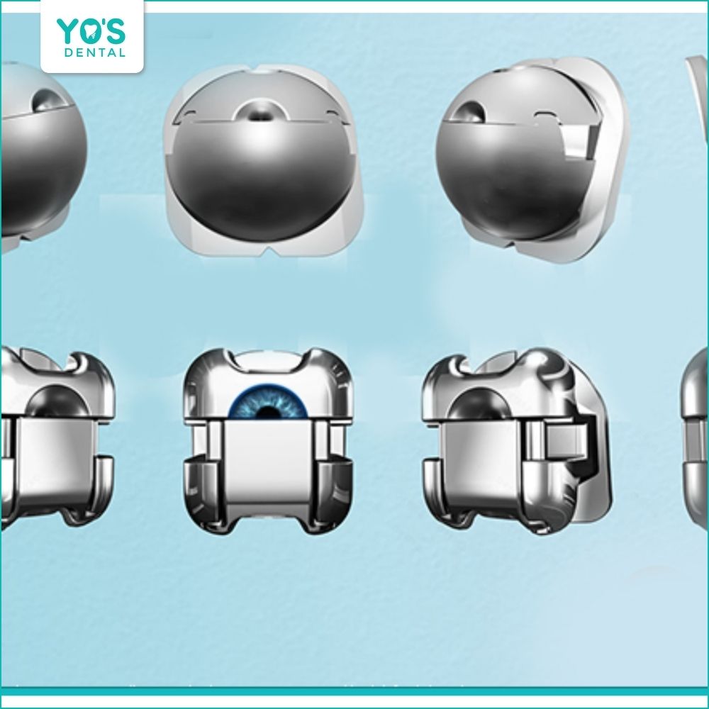 Mắc cài cánh cam được gia công chính xác, bo tròn, bề mặt nhẵn, làm từ thép không gỉ hoặc titanium bền chắc giúp chống ăn mòn hiệu quả
