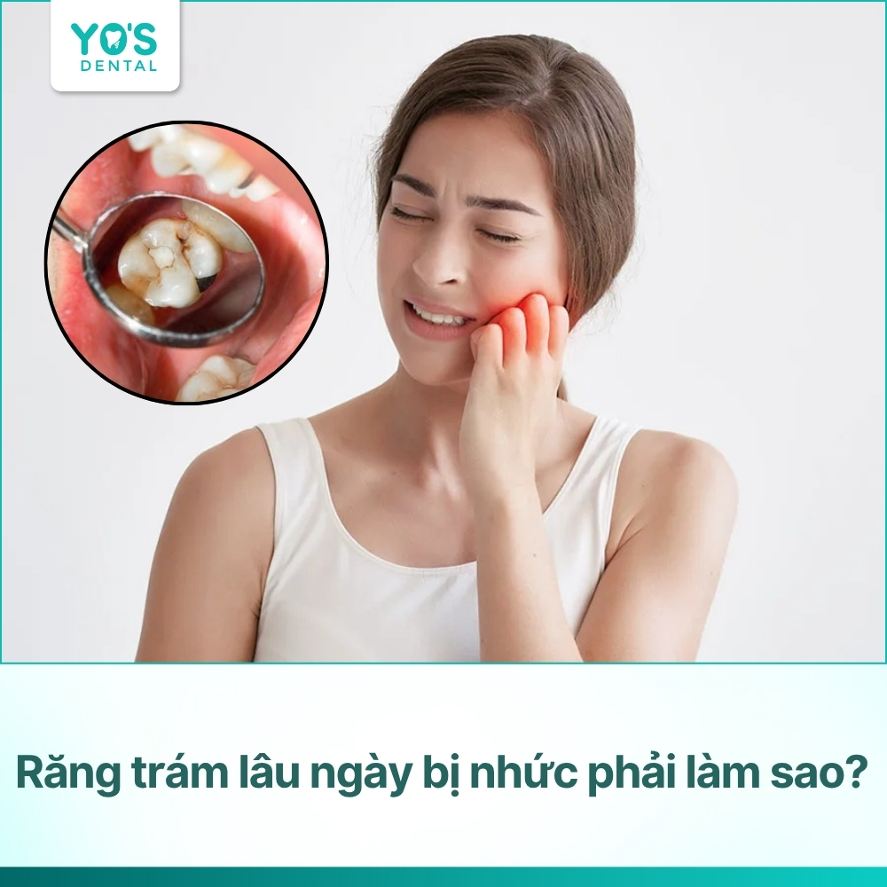 Răng trám lâu ngày bị nhức phải làm sao? Nguyên nhân, giải pháp