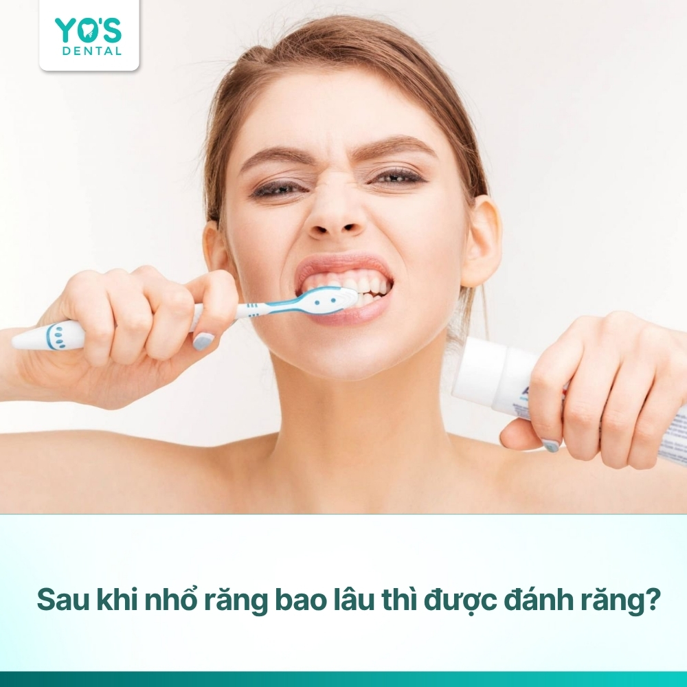 Sau khi nhổ răng bao lâu thì được đánh răng trở lại bình thường?