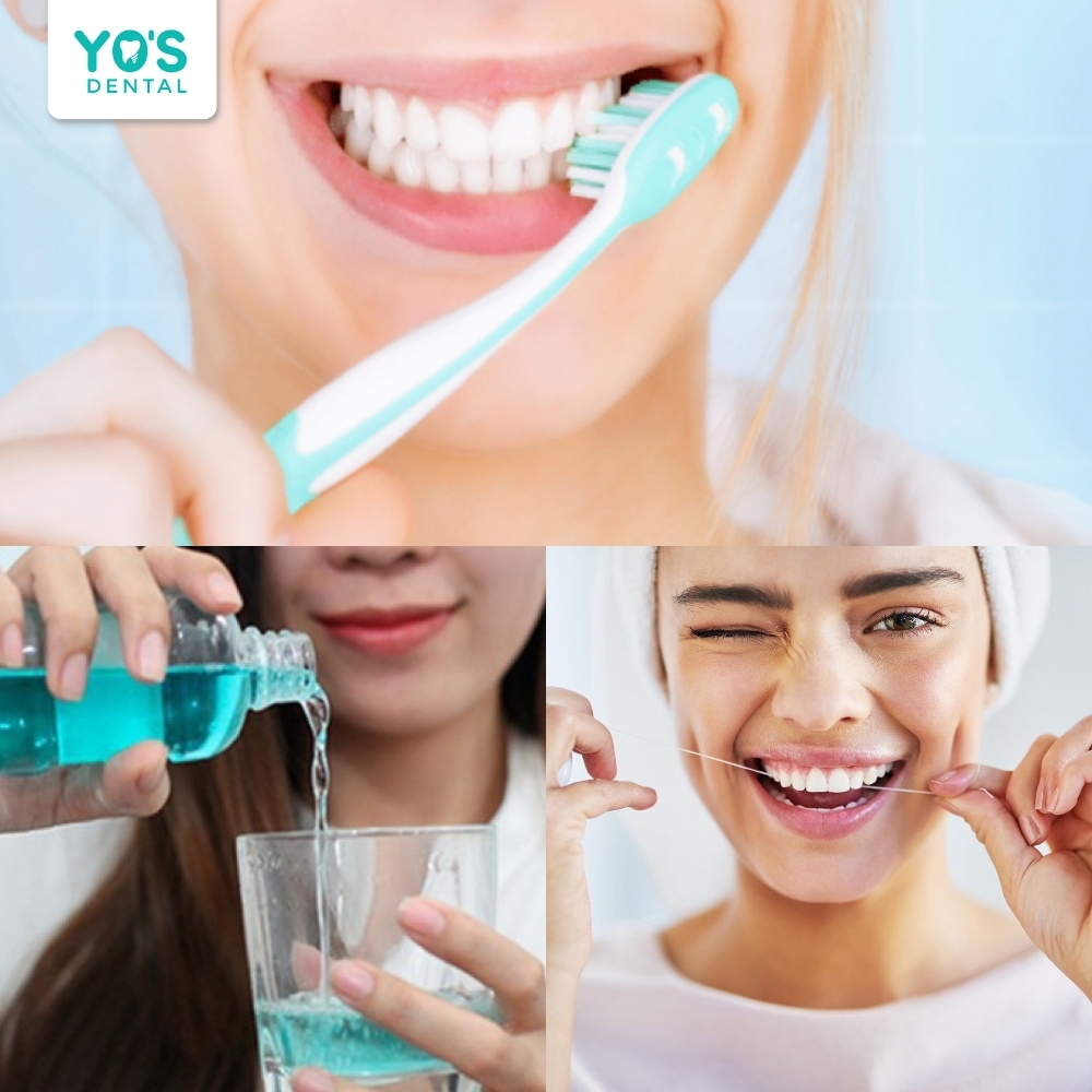 Vệ sinh răng miệng đúng cách giúp bảo vệ răng sau điều trị.